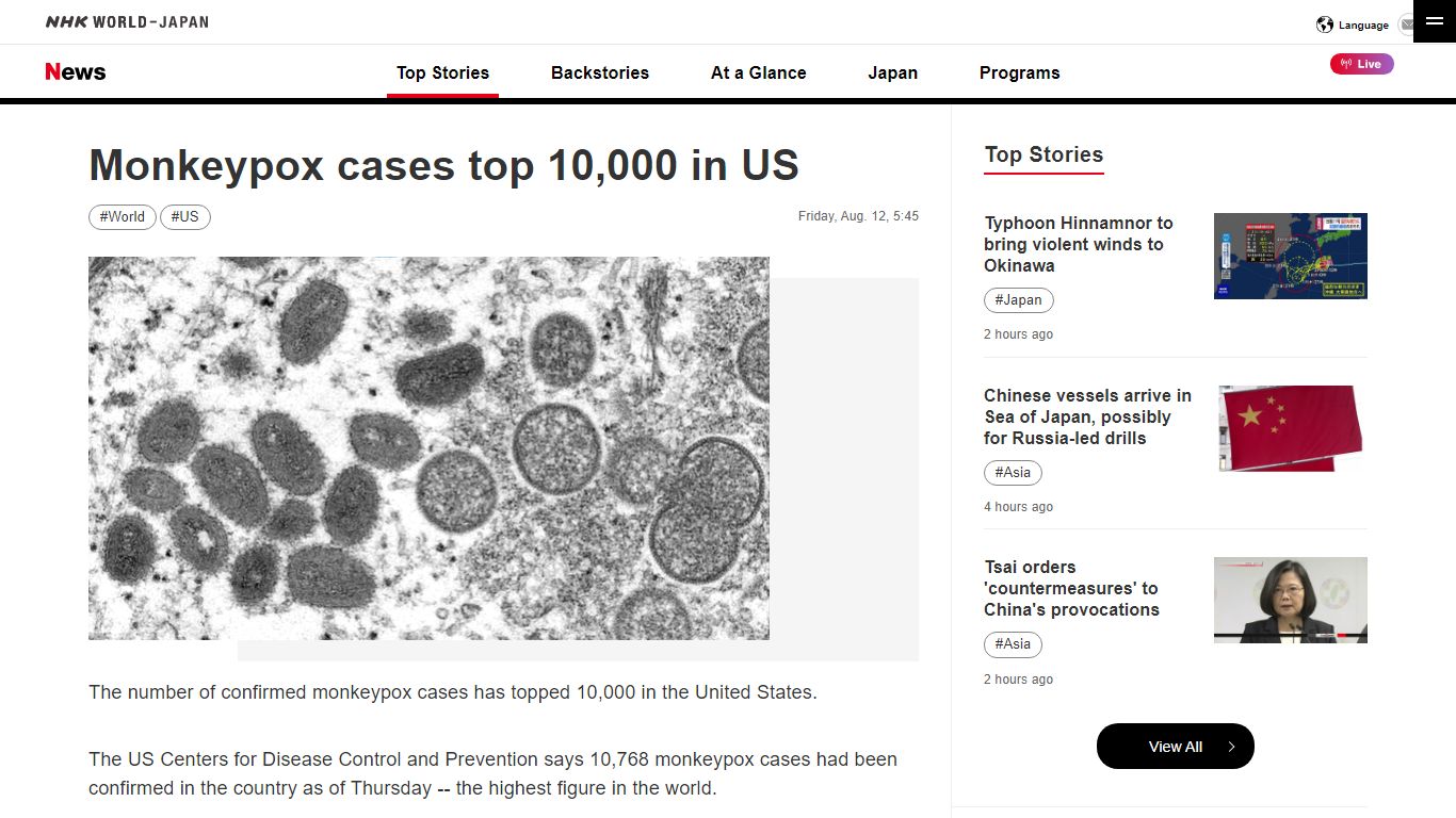 Monkeypox cases top 10,000 in US | NHK WORLD-JAPAN News